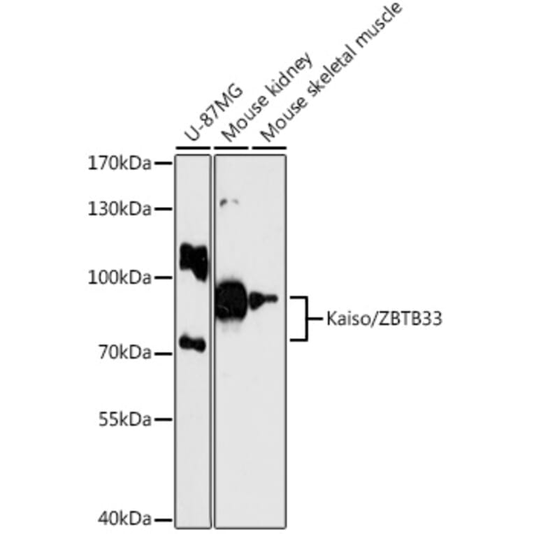 Western Blot - Anti-KAISO Antibody (A87683) - Antibodies.com