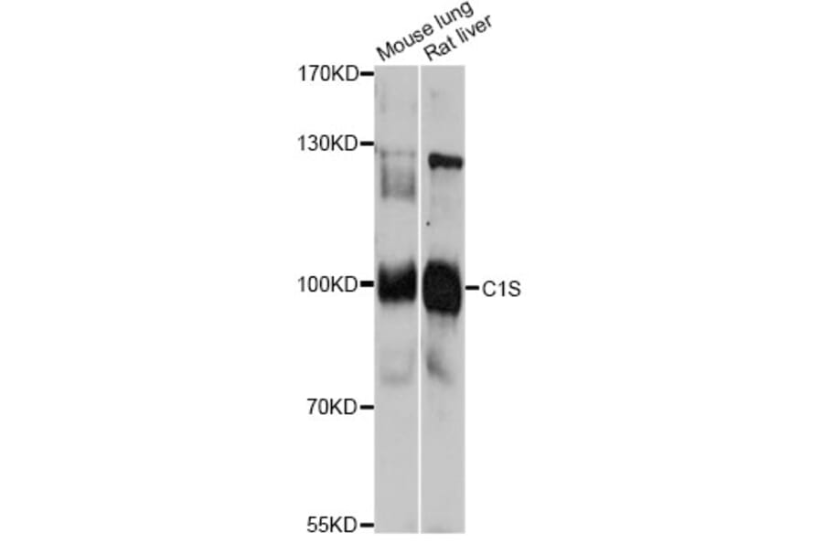 Western Blot - Anti-C1S Antibody (A13282) - Antibodies.com