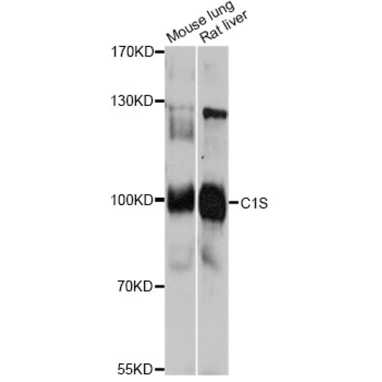 Western Blot - Anti-C1S Antibody (A13282) - Antibodies.com