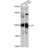 Western Blot - Anti-C1S Antibody (A13282) - Antibodies.com