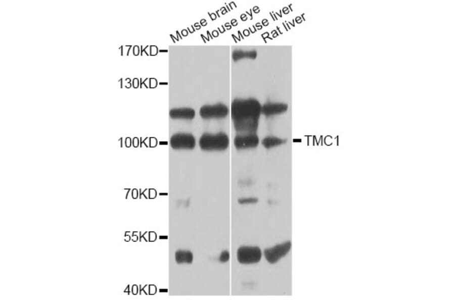 Western Blot - Anti-TMC1 Antibody (A12609) - Antibodies.com