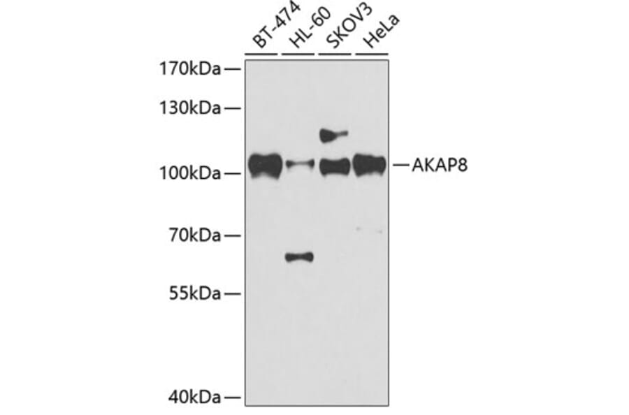 Western Blot - Anti-AKAP 95 Antibody (A87687) - Antibodies.com