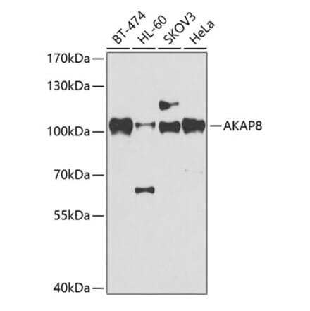 Western Blot - Anti-AKAP 95 Antibody (A87687) - Antibodies.com