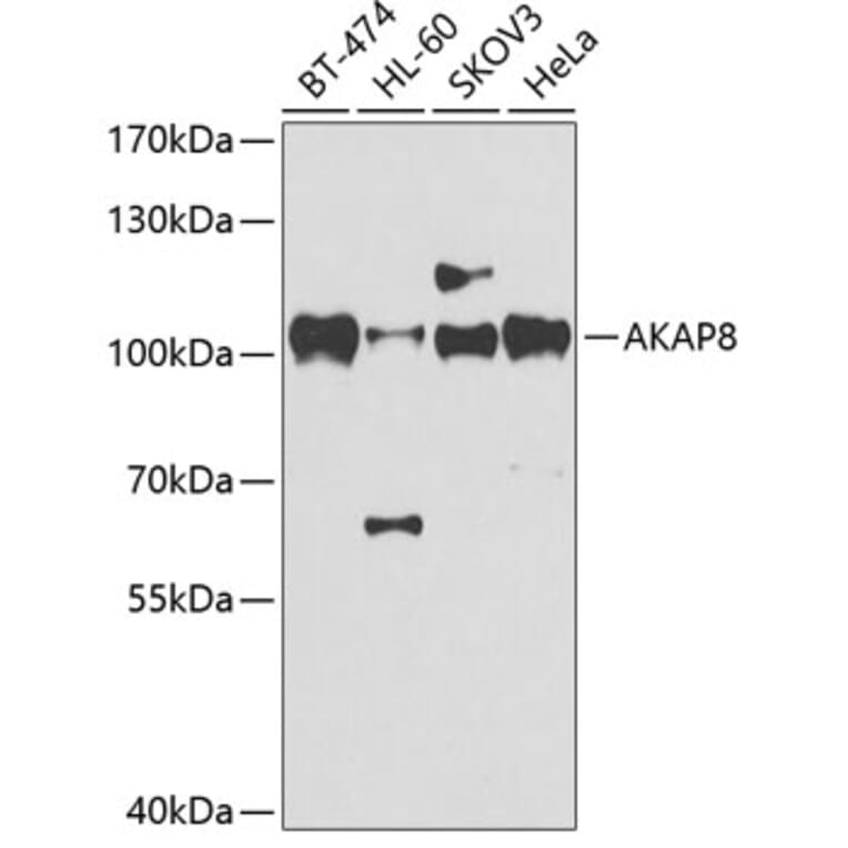 Western Blot - Anti-AKAP 95 Antibody (A87687) - Antibodies.com