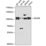 Western Blot - Anti-AKAP 95 Antibody (A87687) - Antibodies.com