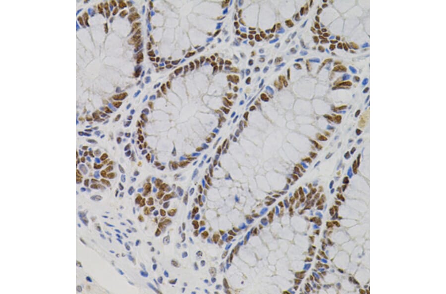 Immunohistochemistry - Anti-AKAP 95 Antibody (A87687) - Antibodies.com