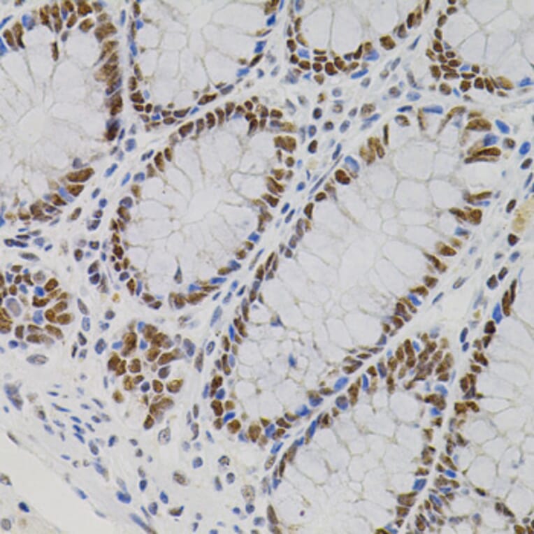 Immunohistochemistry - Anti-AKAP 95 Antibody (A87687) - Antibodies.com