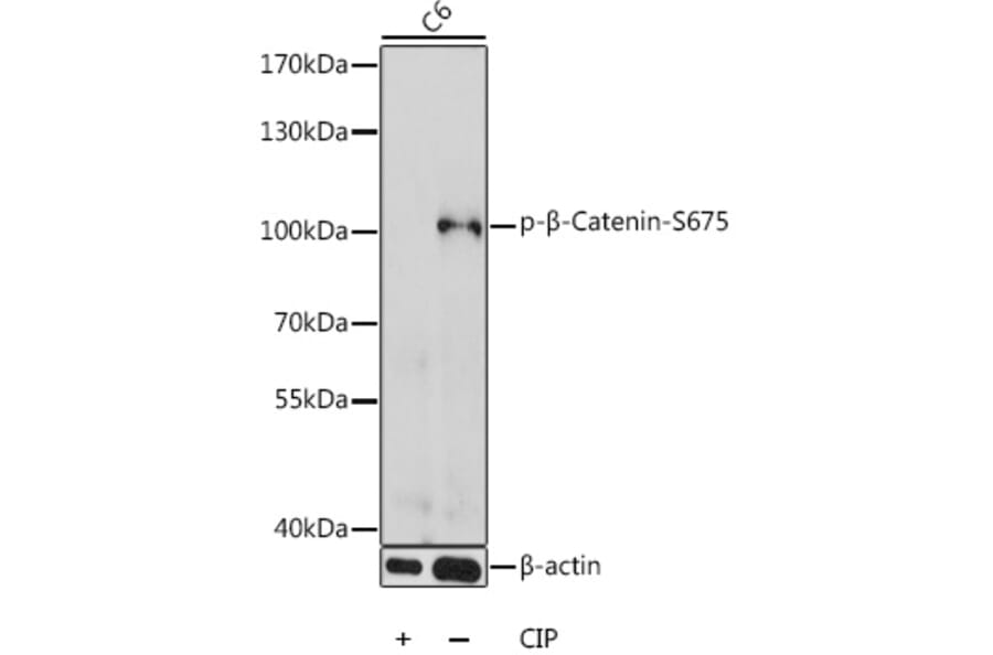Western Blot - Anti-beta Catenin (phospho Ser675) Antibody (A87689) - Antibodies.com