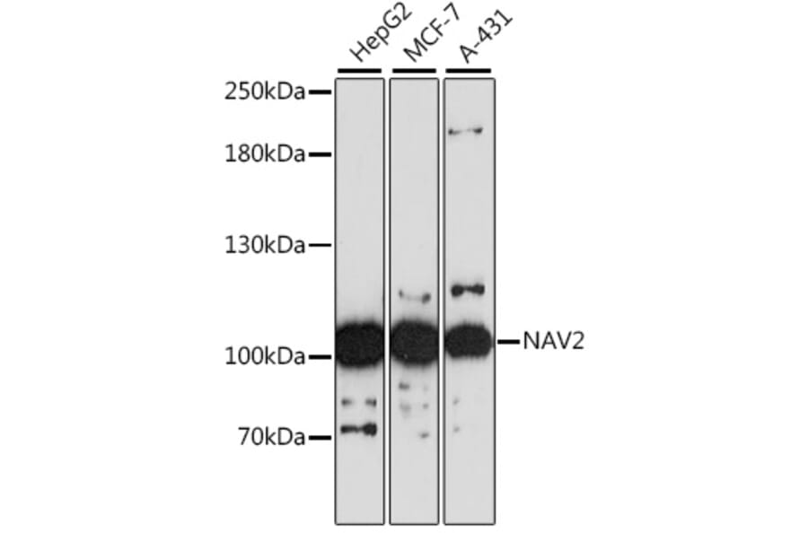 Western Blot - Anti-NAV2 Antibody (A87690) - Antibodies.com