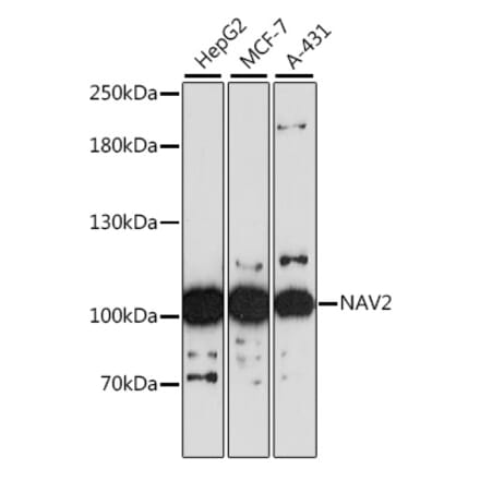 Western Blot - Anti-NAV2 Antibody (A87690) - Antibodies.com