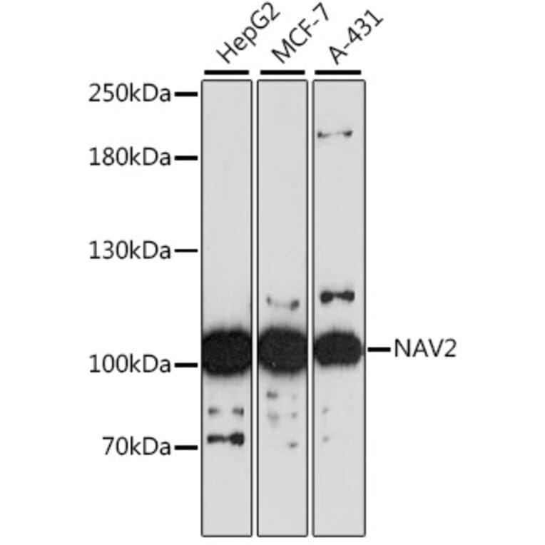 Western Blot - Anti-NAV2 Antibody (A87690) - Antibodies.com