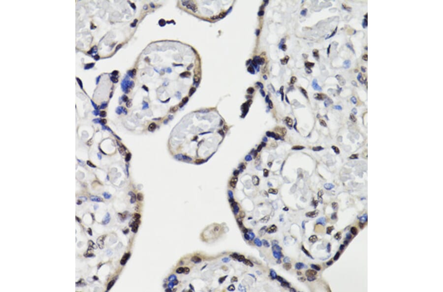 Immunohistochemistry - Anti-NAV2 Antibody (A87690) - Antibodies.com