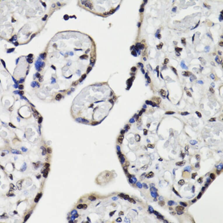 Immunohistochemistry - Anti-NAV2 Antibody (A87690) - Antibodies.com