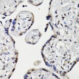 Immunohistochemistry - Anti-NAV2 Antibody (A87690) - Antibodies.com