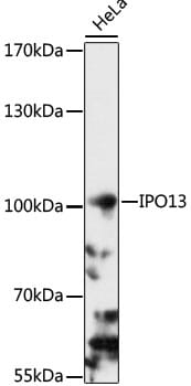 Western blot analysis of extracts of HeLa cells, using Anti-IPO13 Antibody (A16472) at 1:1,000 dilution.
Secondary antibody: Goat Anti-Rabbit IgG (H+L) (HRP) (AS014) at 1:10,000 dilution.
Lysates / proteins: 25µg per lane.
Blocking buffer: 3% non-fat dry milk in TBST.
Detection: ECL Basic Kit (RM00020).
Exposure time: 90s.