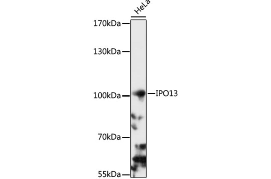Western Blot - Anti-Importin 13 Antibody (A87691) - Antibodies.com
