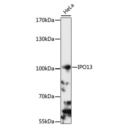 Western Blot - Anti-Importin 13 Antibody (A87691) - Antibodies.com