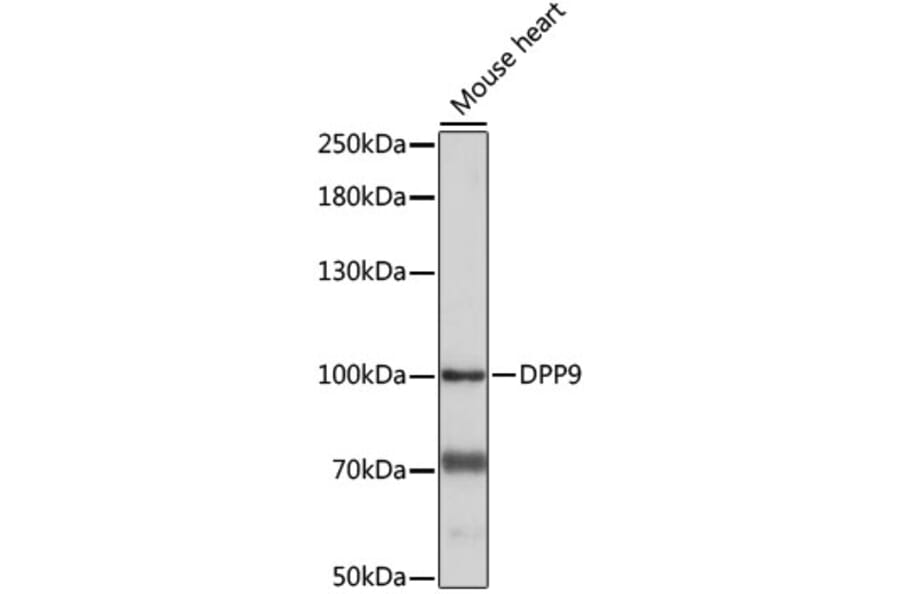 Western Blot - Anti-DPP9 Antibody (A87693) - Antibodies.com