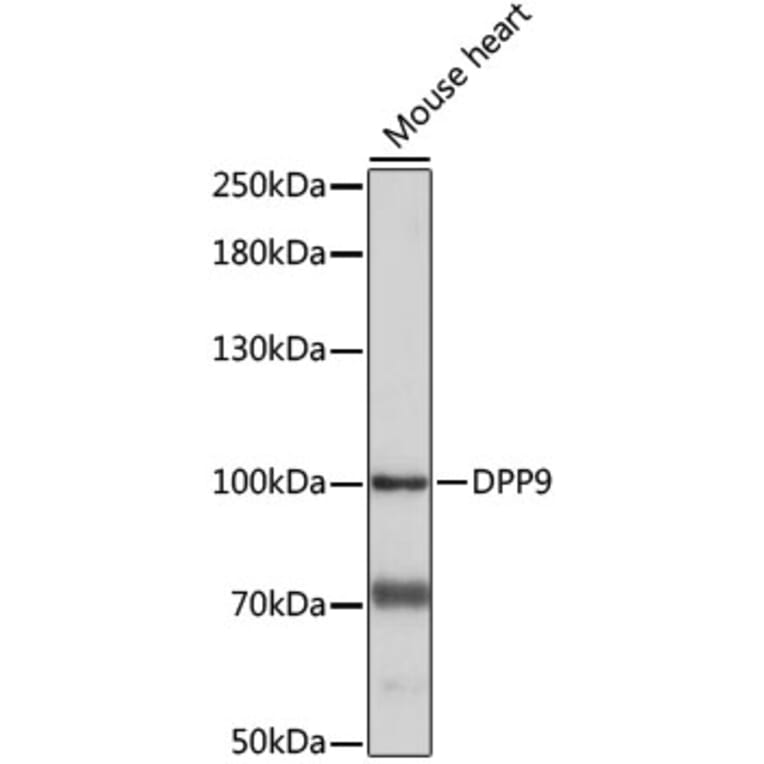 Western Blot - Anti-DPP9 Antibody (A87693) - Antibodies.com