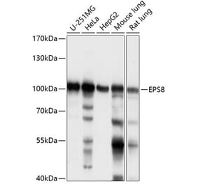 Western Blot - Anti-EPS8 Antibody (A87694) - Antibodies.com