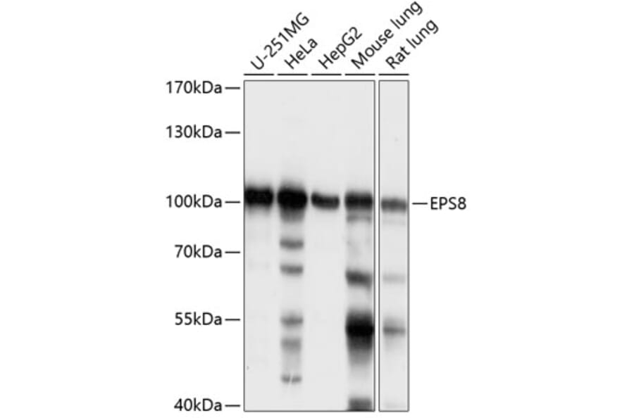 Western Blot - Anti-EPS8 Antibody (A87694) - Antibodies.com