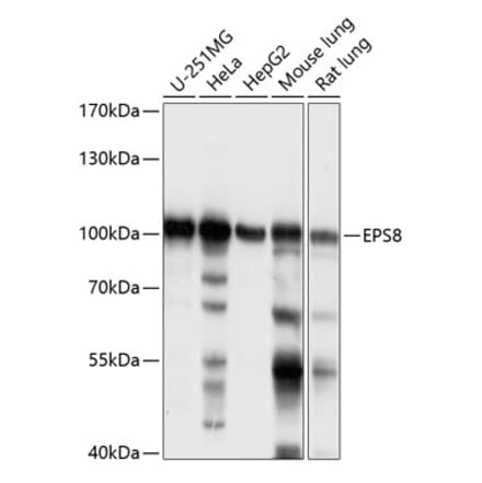 Western Blot - Anti-EPS8 Antibody (A87694) - Antibodies.com