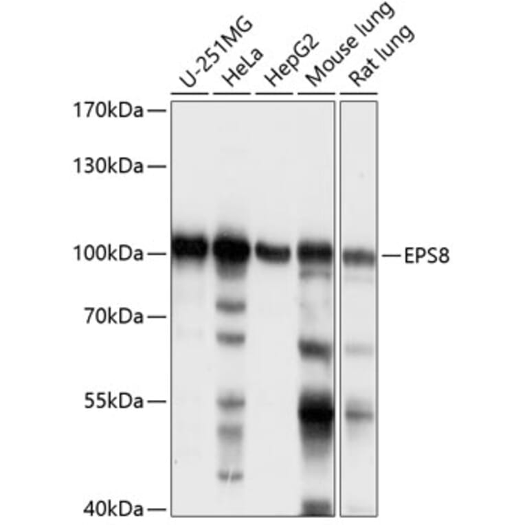 Western Blot - Anti-EPS8 Antibody (A87694) - Antibodies.com