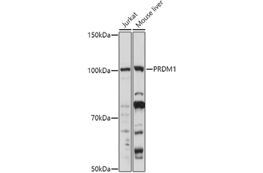 Western Blot - Anti-PRDM1/Blimp1 Antibody (A87695) - Antibodies.com