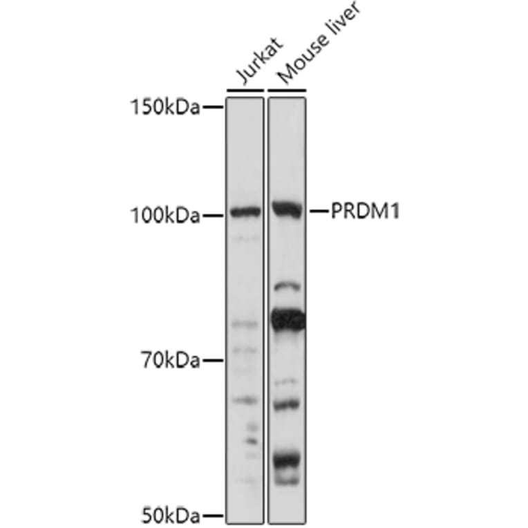 Western Blot - Anti-PRDM1/Blimp1 Antibody (A87695) - Antibodies.com