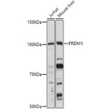 Western Blot - Anti-PRDM1/Blimp1 Antibody (A87695) - Antibodies.com