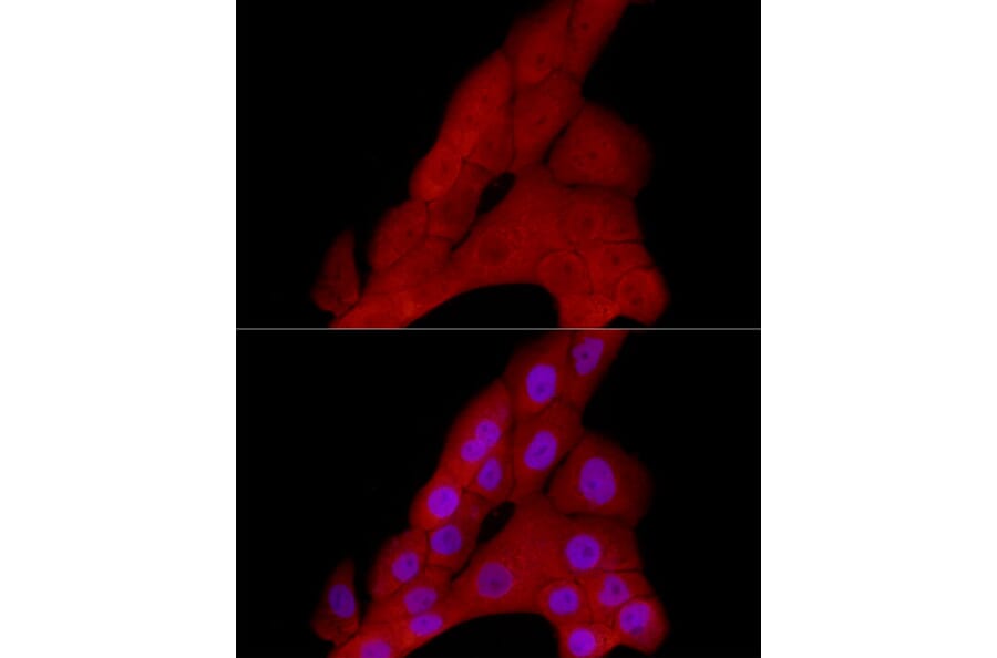 Immunofluorescence - Anti-PRDM1/Blimp1 Antibody (A87695) - Antibodies.com