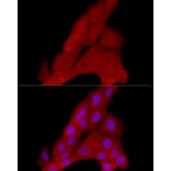 Immunofluorescence - Anti-PRDM1/Blimp1 Antibody (A87695) - Antibodies.com