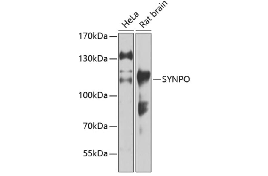 Western Blot - Anti-Synaptopodin Antibody (A87696) - Antibodies.com