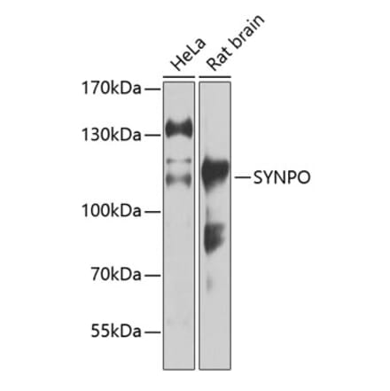 Western Blot - Anti-Synaptopodin Antibody (A87696) - Antibodies.com