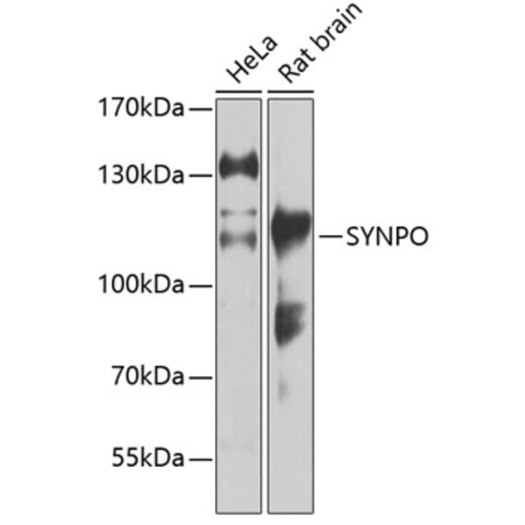 Western Blot - Anti-Synaptopodin Antibody (A87696) - Antibodies.com