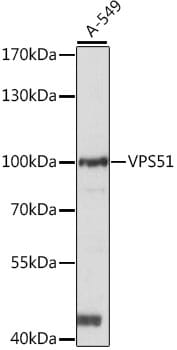 Western blot analysis of extracts of A-549 cells, using Anti-VPS51 Antibody (A15651) at 1:1,000 dilution.
Secondary antibody: Goat Anti-Rabbit IgG (H+L) (HRP) (AS014) at 1:10,000 dilution.
Lysates / proteins: 25µg per lane.
Blocking buffer: 3% non-fat dry milk in TBST.
Detection: ECL Basic Kit (RM00020).
Exposure time: 10s.