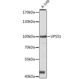 Western Blot - Anti-FFR Antibody (A87697) - Antibodies.com