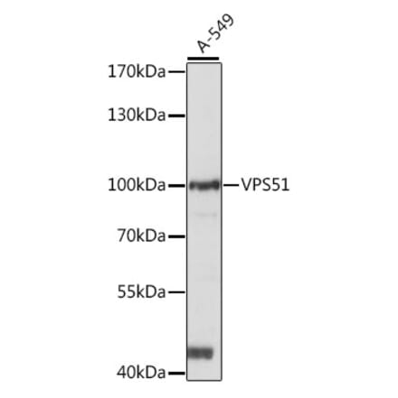 Western Blot - Anti-FFR Antibody (A87697) - Antibodies.com