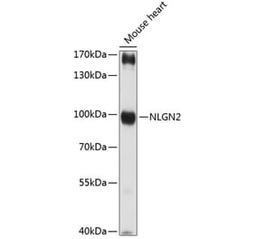 Western Blot - Anti-Neuroligin 2 Antibody (A87698) - Antibodies.com