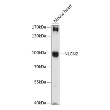 Western Blot - Anti-Neuroligin 2 Antibody (A87698) - Antibodies.com