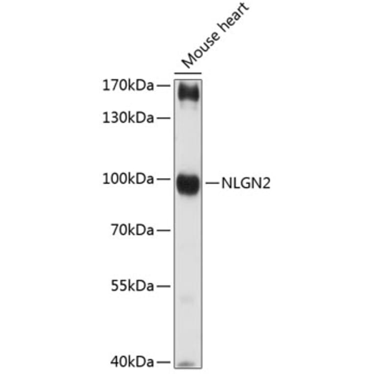 Western Blot - Anti-Neuroligin 2 Antibody (A87698) - Antibodies.com