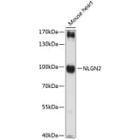 Western Blot - Anti-Neuroligin 2 Antibody (A87698) - Antibodies.com