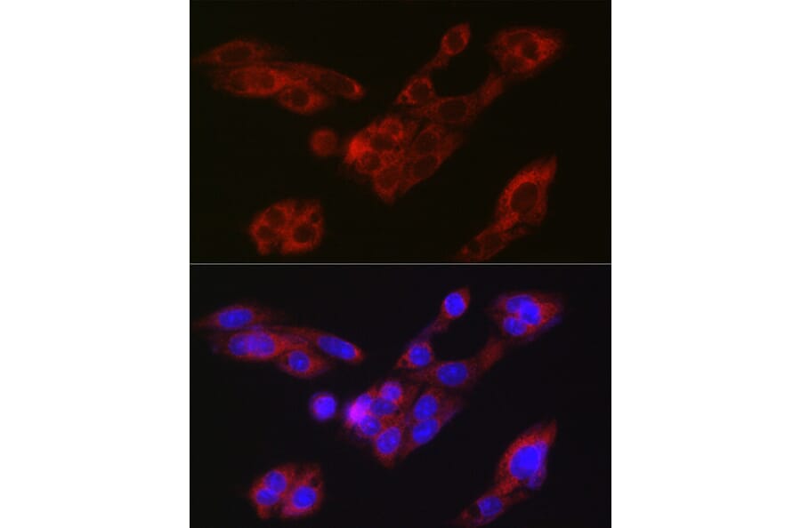 Immunofluorescence - Anti-ATG9A Antibody (A87700) - Antibodies.com