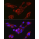 Immunofluorescence - Anti-ATG9A Antibody (A87700) - Antibodies.com