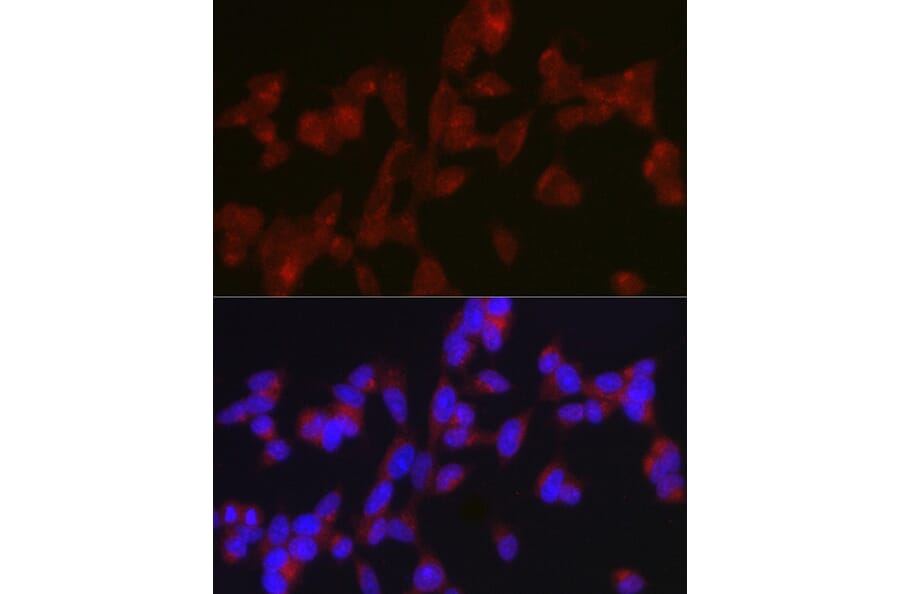 Immunofluorescence - Anti-ATG9A Antibody (A87700) - Antibodies.com