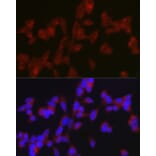 Immunofluorescence - Anti-ATG9A Antibody (A87700) - Antibodies.com