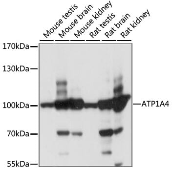 Western blot analysis of extracts of various cell lines, using Anti-ATP1A4 Antibody (A15256) at 1:1,000 dilution.
Secondary antibody: Goat Anti-Rabbit IgG (H+L) (HRP) (AS014) at 1:10,000 dilution.
Lysates / proteins: 25µg per lane.
Blocking buffer: 3% non-fat dry milk in TBST.
Detection: ECL Basic Kit (RM00020).
Exposure time: 1S.