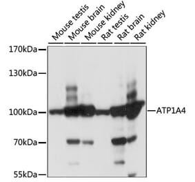 Western Blot - Anti-Sodium Potassium ATPase Antibody (A87701) - Antibodies.com