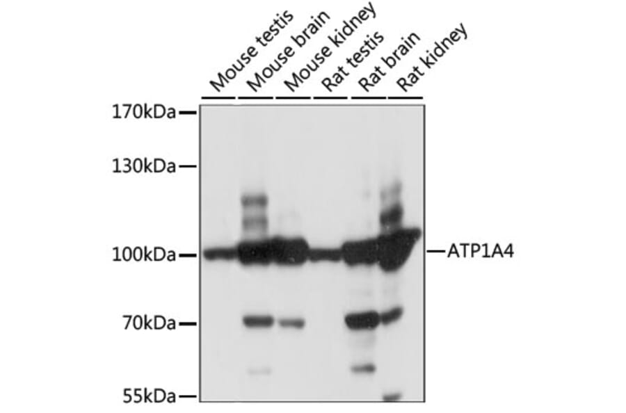 Western Blot - Anti-Sodium Potassium ATPase Antibody (A87701) - Antibodies.com