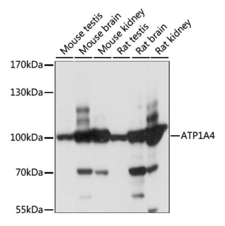 Western Blot - Anti-Sodium Potassium ATPase Antibody (A87701) - Antibodies.com